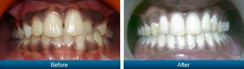 Smile Gallery