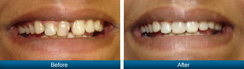 Smile Gallery