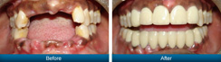 Smile Gallery